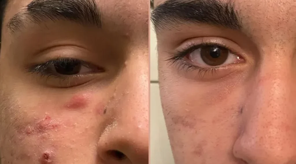 découvrez comment les chauffeurs de tesla semi sont conquis après une longue période d'attente, grâce à ses performances innovantes et son confort exceptionnel.